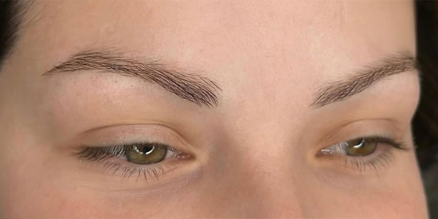 dermillusion-avant1 dermillusion-avant1